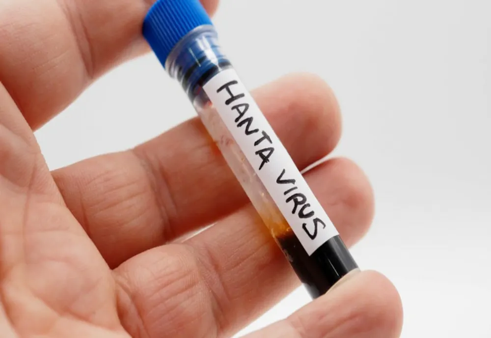  Un nou caz de hantavirus depistat în România. Pacientul este internat în Oradea